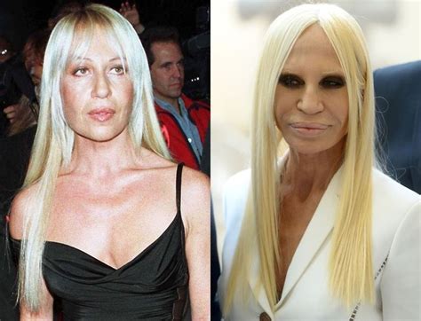 donatella saying versace|donatella versace before plastic surgery.